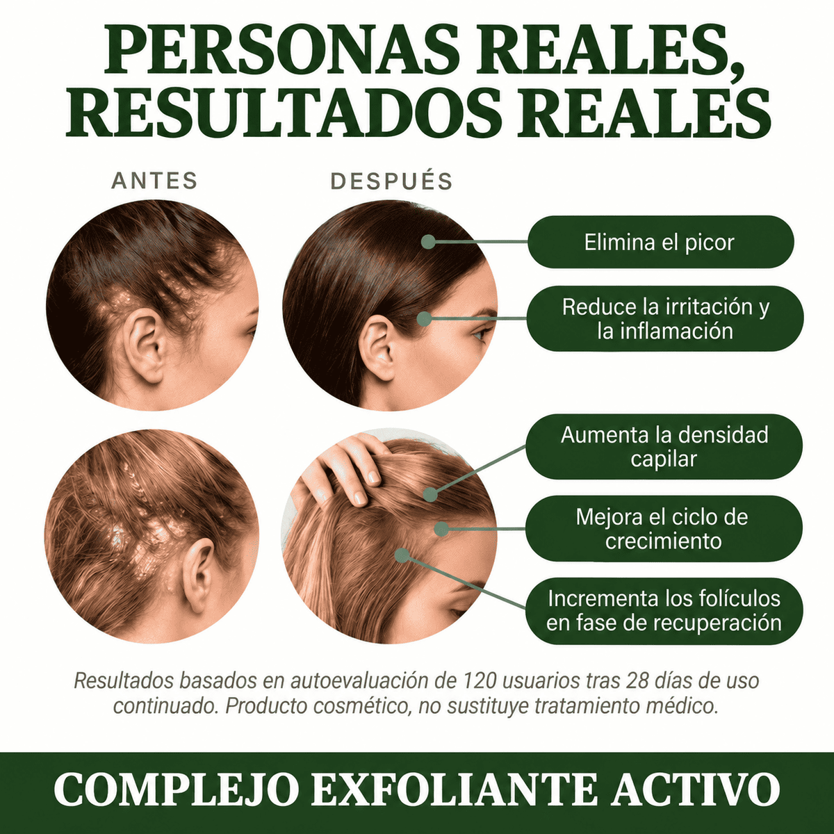 Exfoliante Capilar Natural Scalvia