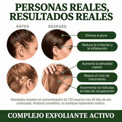Exfoliante Capilar Natural Scalvia