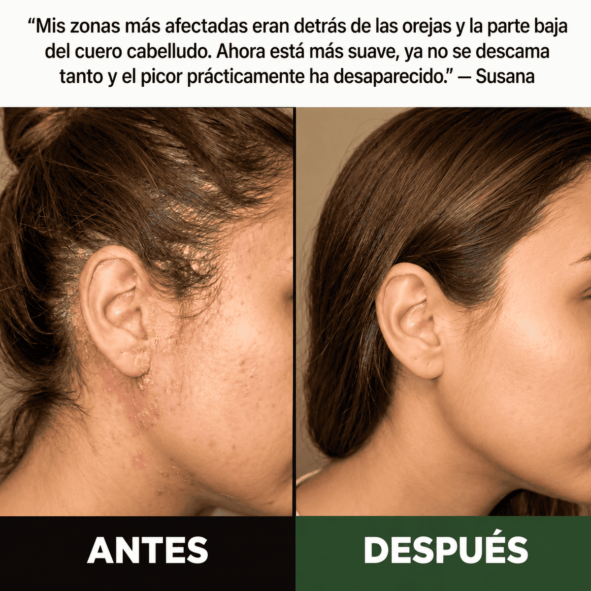 Exfoliante Capilar Natural Scalvia